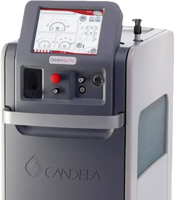 Candela Laser Hair Removal Croydon