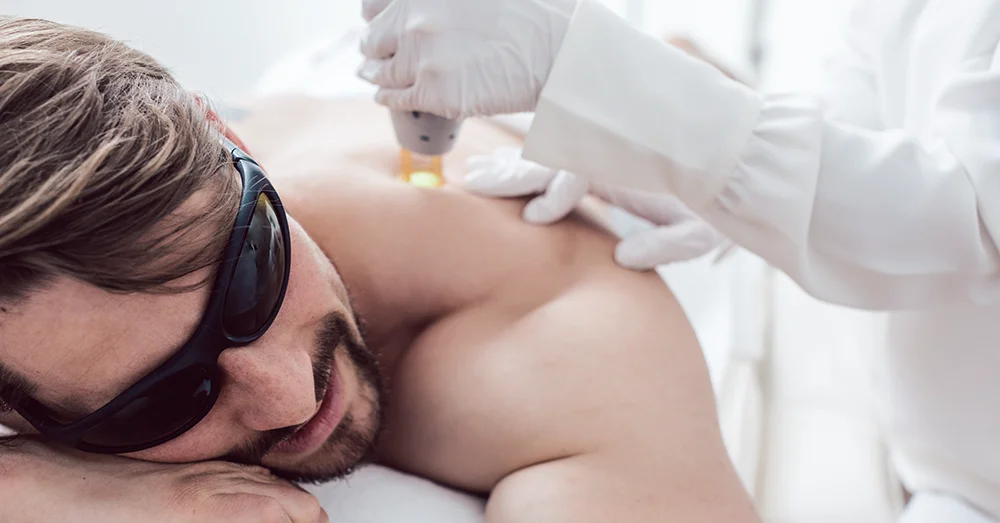 Laser treatment in Croydon for back hair removal
